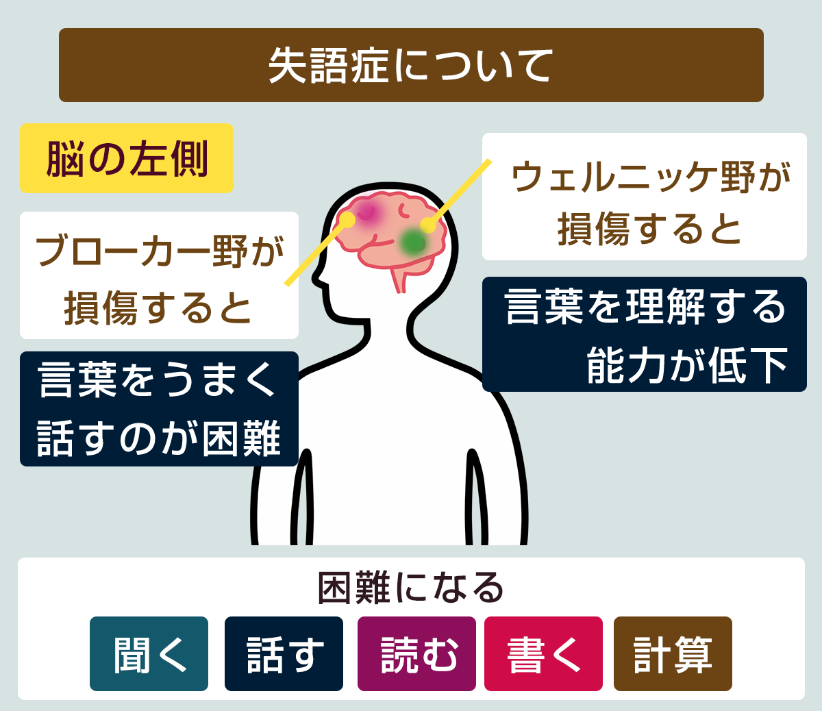 失語症の解説画像。言語野が損傷されると、聞く、話す、読む、書く、計算が困難になる。ブローカー野が損傷すると、言葉をうまく話すのが困難になります。ウェルニッケ野が損傷すると、言葉を理解する能力が低下します。