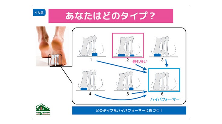 「イカ足」とは? 2