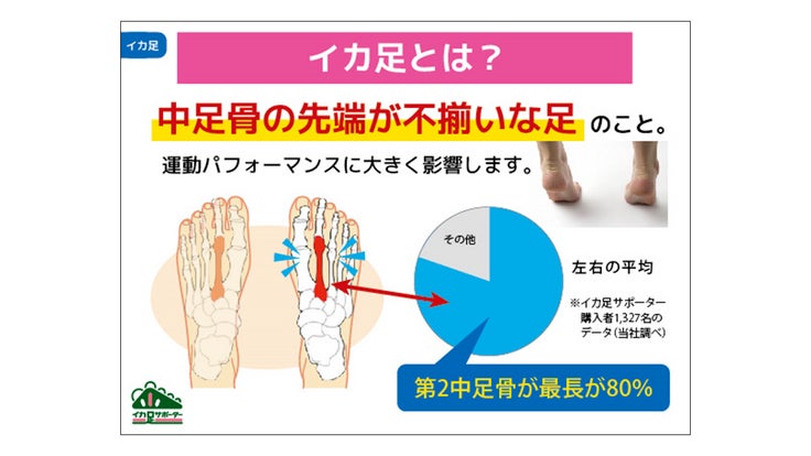 「イカ足」とは?