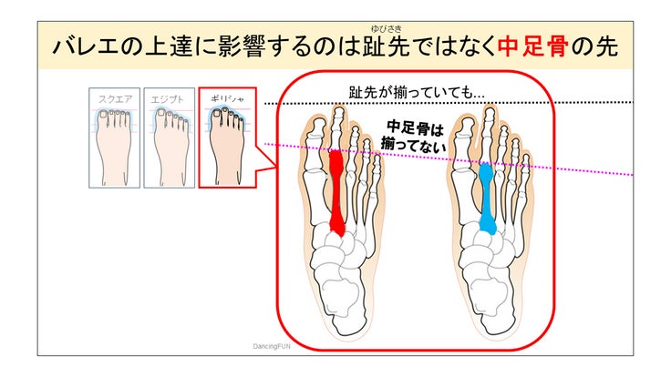バレエの上達に影響するのは趾先ではなく中足骨の先