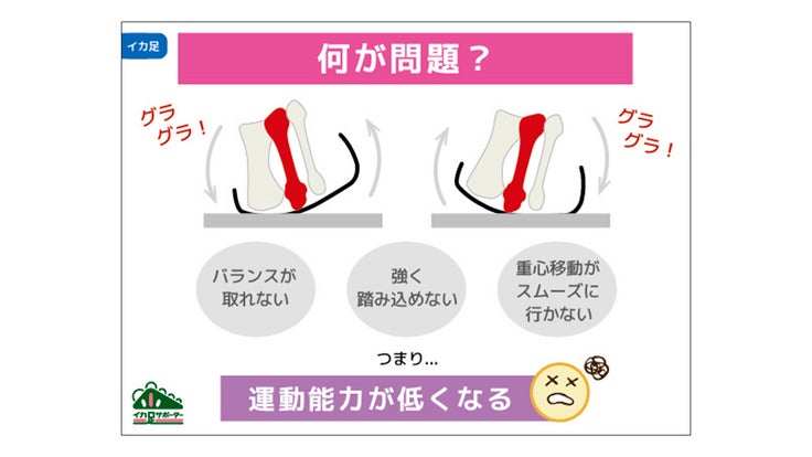 「イカ足」とは? 4