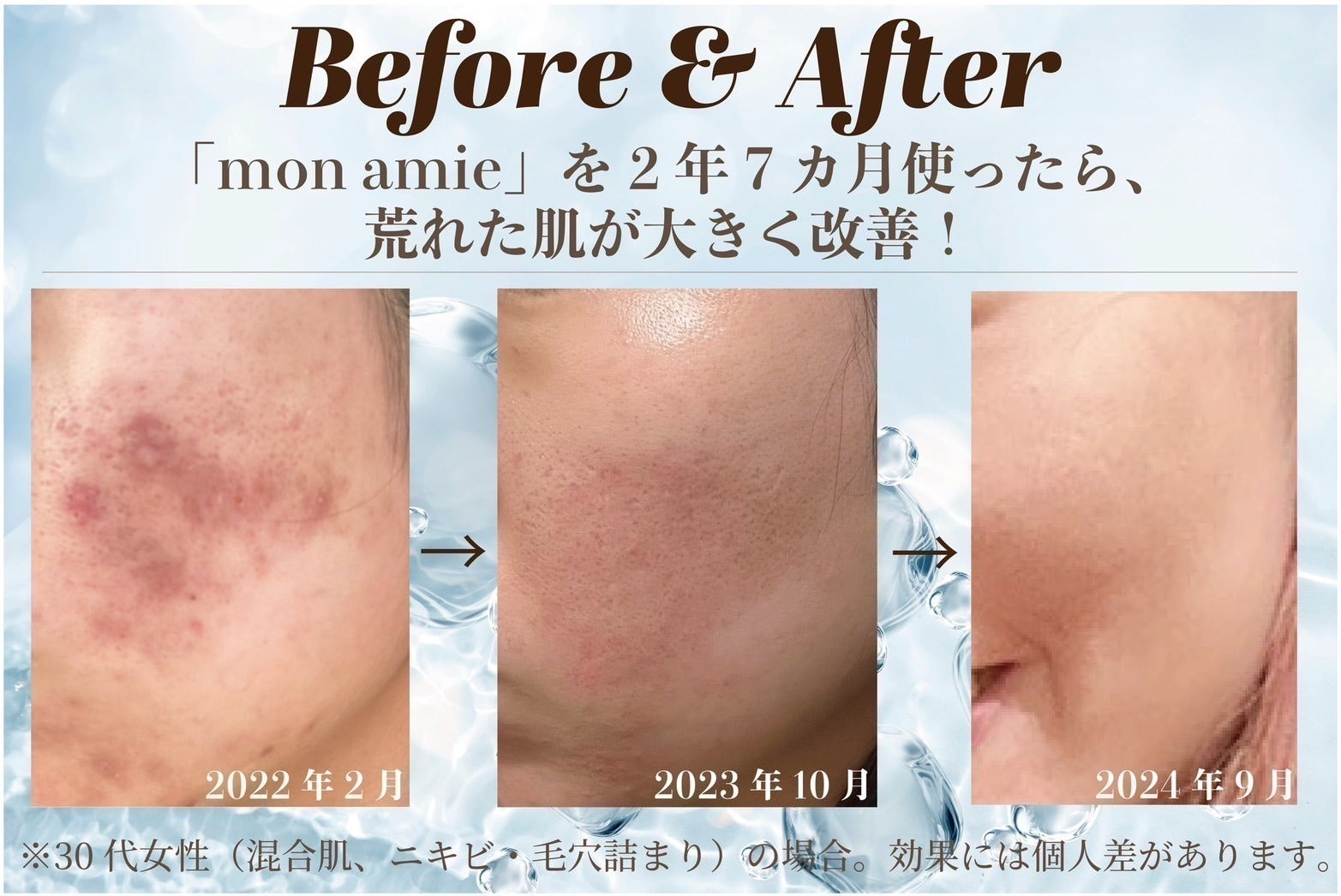 2番目のメイン画像