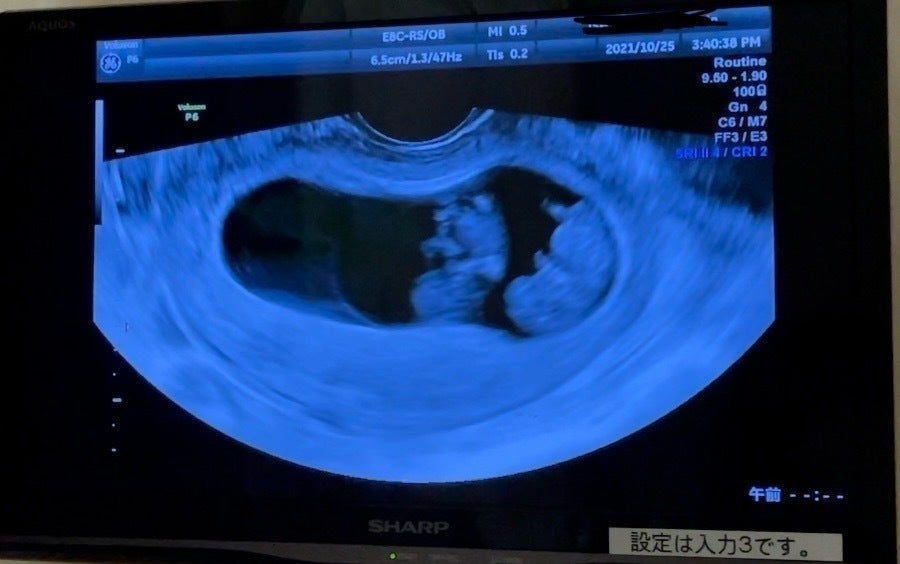 2番目のメイン画像